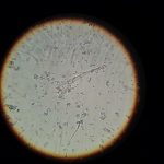 microbioma psiquiatría bacterias